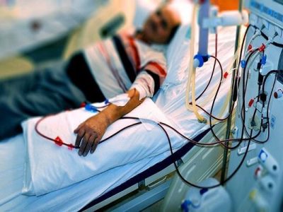 گیلان چند بیمار دیالیزی در انتظار پیوند دارد؟